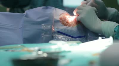 Glaucomul